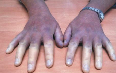 无法治愈的疾病有治疗必要吗,无法治愈的疾病目录