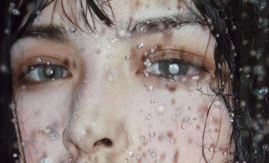 消除黑眼圈和眼袋的最有效的方法,熬夜出来的黑眼圈有什么办法消除