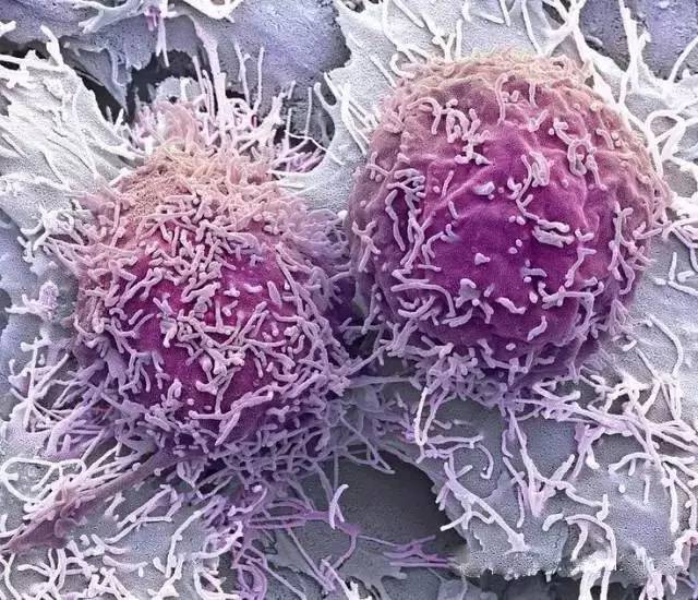 Word天！想不到癌细胞如此惊艳