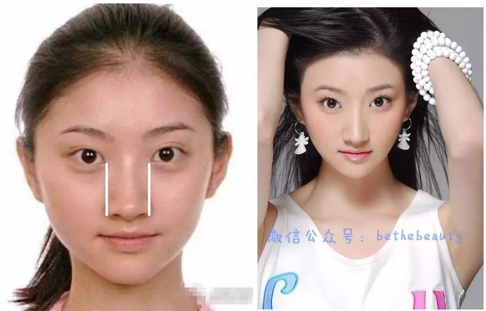 鼻子除了整容变挺还有什么办法,不想整容怎么让鼻子好看