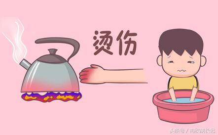 面对宝宝烫伤,亲们千万不慌,谨记宝宝烫伤的最佳处理时间