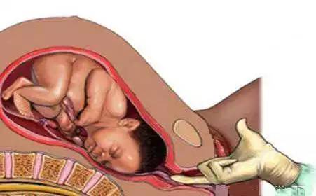 「科普」剖腹产的女明星那么多,为啥瘦小的“教主夫人”(杨颖)却能顺产?