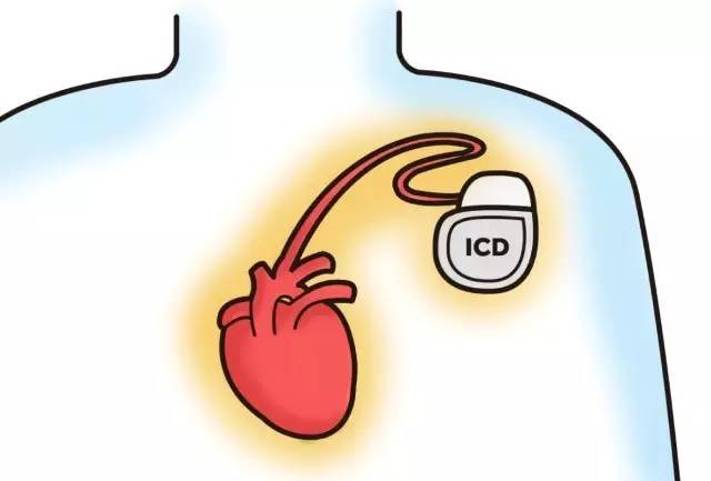 “心泵”马力不足恐致命，哪些指标是预警信号？