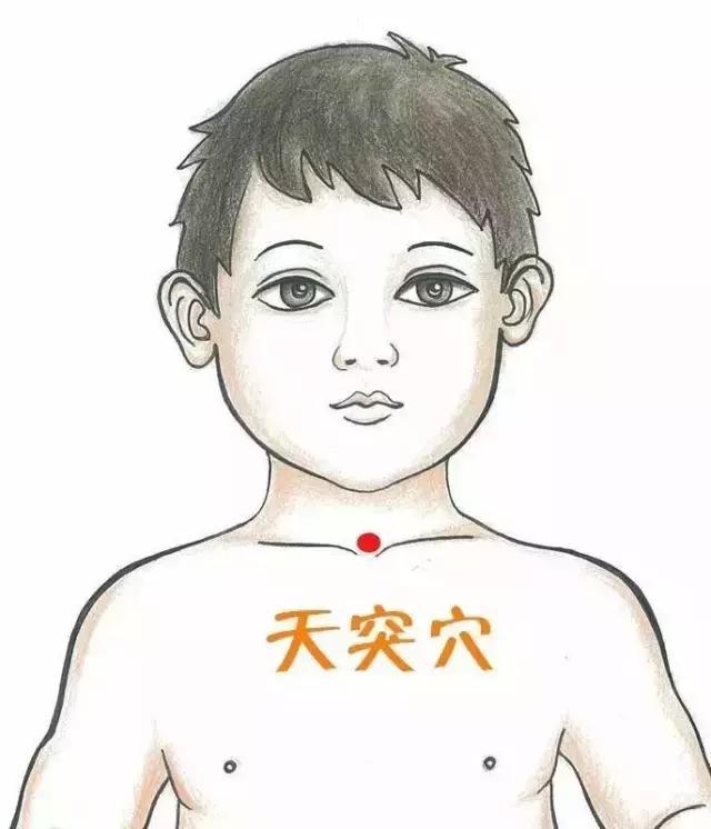 儿童急性支气管炎的最佳止咳方法,儿童咳嗽快速止咳小妙招支气管炎