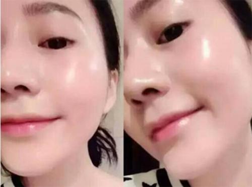 冬天敷面膜太冷了怎么办,冬天敷海藻面膜热好还是冷好