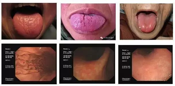 舌苔辨证图谱望舌识病,揭秘舌苔图谱轻松自诊