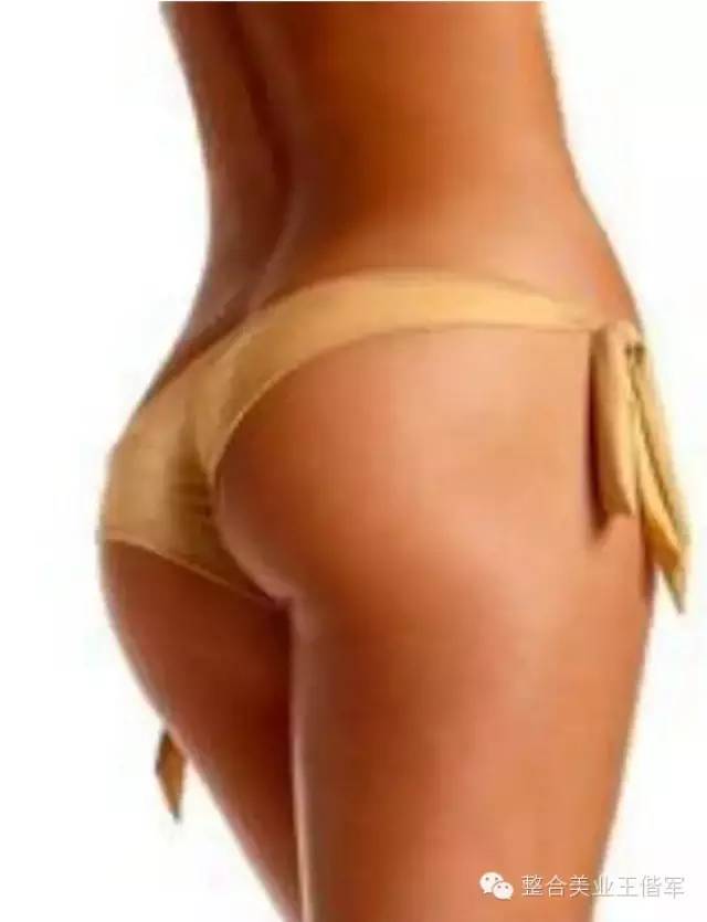 拒绝产后大肚腩轻轻松松搞定,盆腔臀疗手法