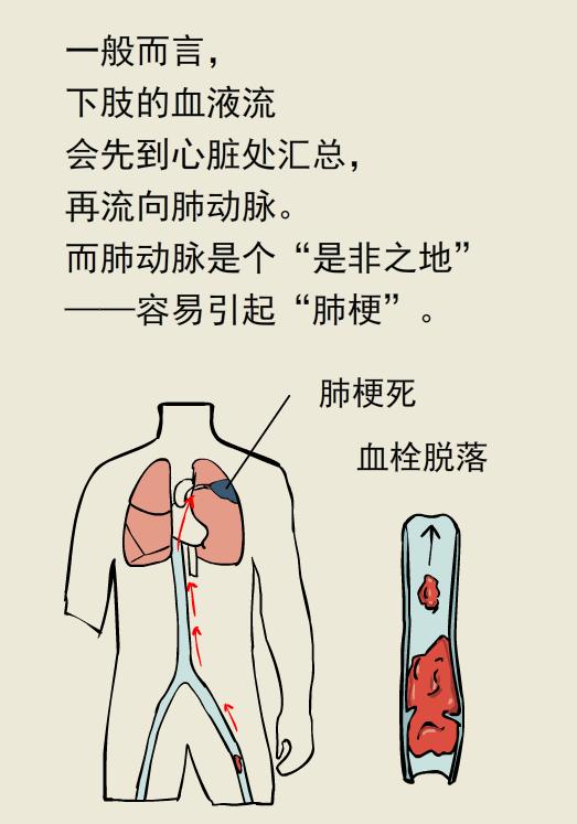 单腿肿和双腿肿的区别,两条腿肿的程度不一样