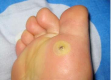 家庭足部按摩小知识,足部健康专业护理