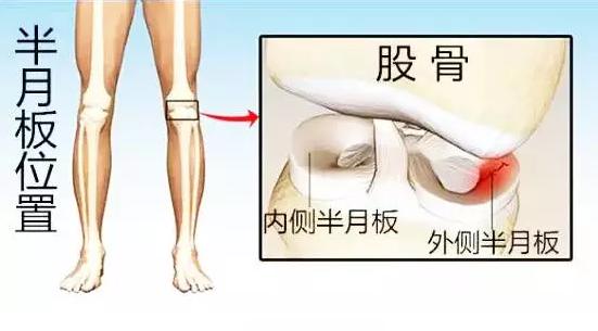膝盖垫片磨损疼吃什么药缓解,膝盖痛可能是什么问题
