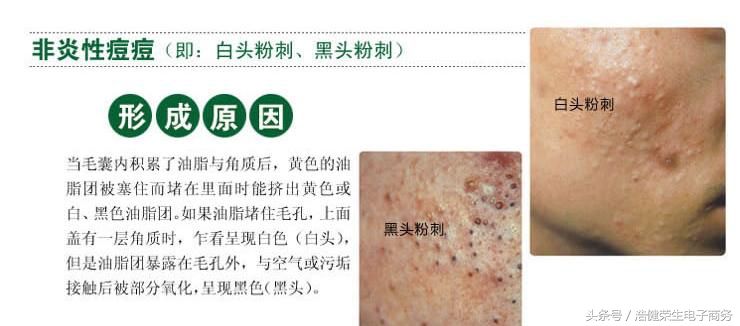 不要小看这些症状,不要小看你的疾病