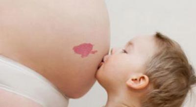 胎记不及时治疗会恶变吗,胎记不治疗对生命有影响吗