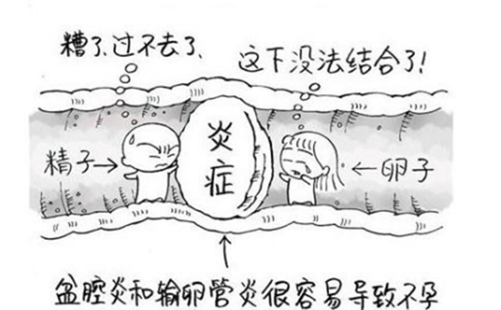 怀不上宝宝有原因，却也不能草木皆兵！快来给火锅丸子平反