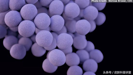 皮肤科普健康知识讲座,皮肤病种类图毛囊炎