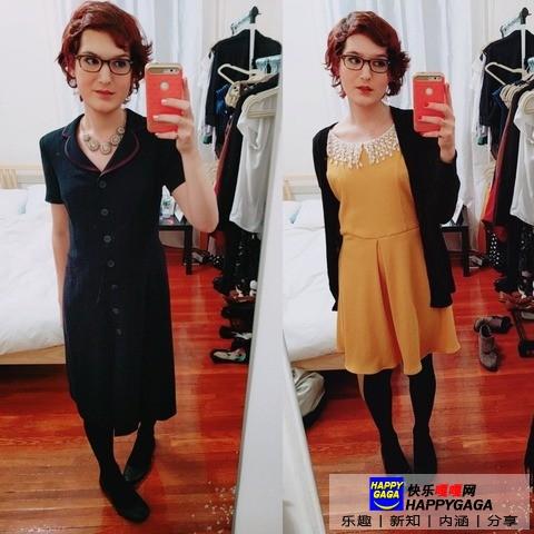 雌激素治脱发,雄性激素脱发补充雌性激素有用吗