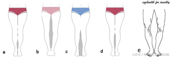 怎么纠正宝宝o型腿,o型腿矫正神器哪种好
