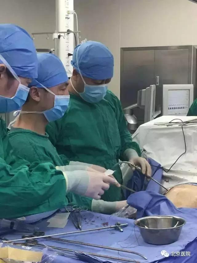 胸外科食道癌手术最好的医院,食管癌手术是胸外科最大的手术