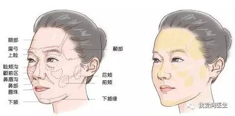 脸上苹果肌上有凹沟填充什么,涨姿势视觉冲击