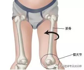 儿童内八字脚穿什么鞋,儿童内八字脚是怎么回事