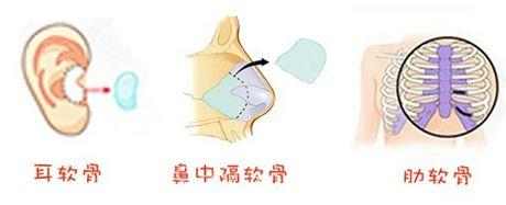 有谁做过达拉斯隆鼻,达拉斯隆鼻区别