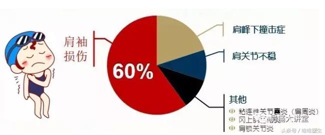 肩周炎积水潭专家,肩周炎医生讲解