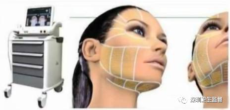 超声刀抗衰老效果,超声波抗衰美容效果怎么样