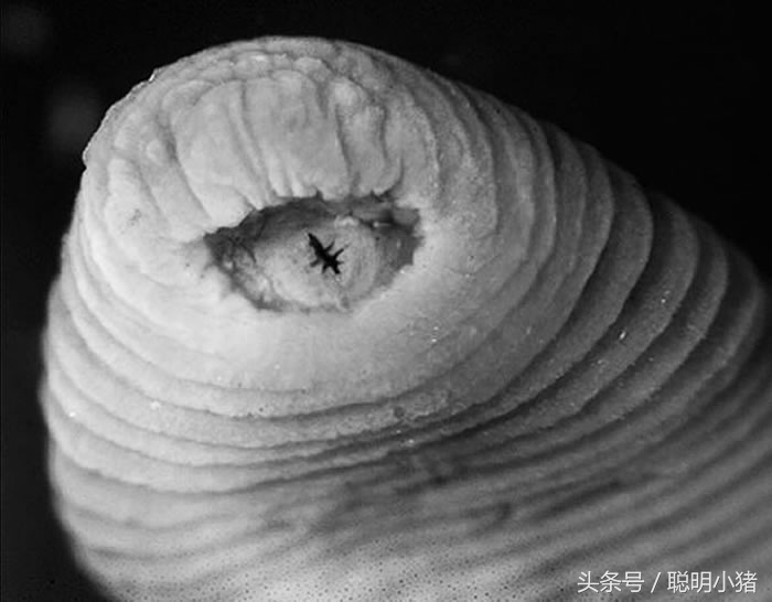 哪些生物可能爬进你体内?