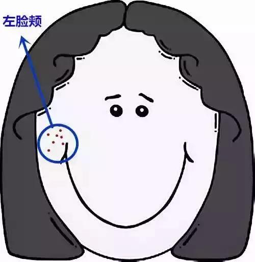 痘痘里挤出来的白色的痘痘怎么办,手臂上有很多痘痘挤出来是白色的