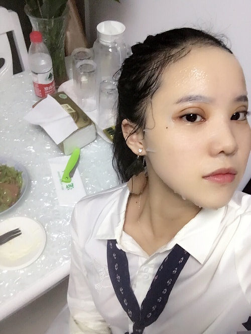 全切双眼皮疤痕增生多久可以恢复,全切双眼皮恢复过程经历真实