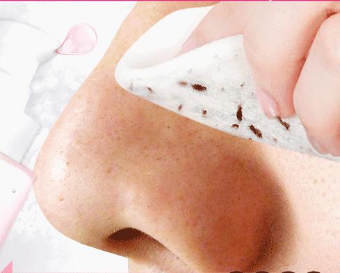 毛孔粗大黑头多脸爱出油怎么解决,毛孔粗大黑头多有闭口脸色暗沉