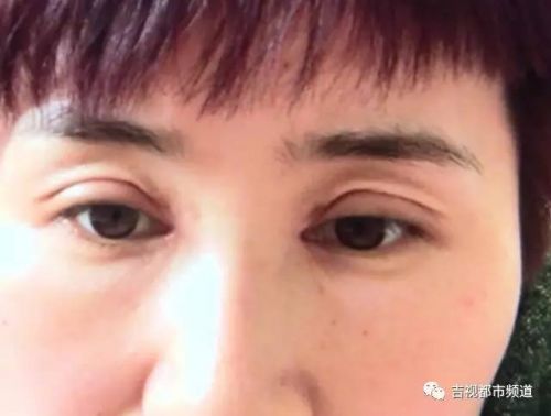 伶秀天成美容院,伶秀天成医疗美容好吗