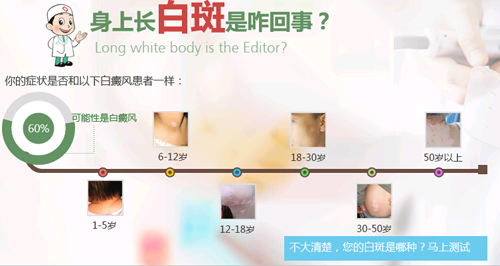 宝宝胳膊上有小白斑怎么回事,手臂有一块一块的白斑