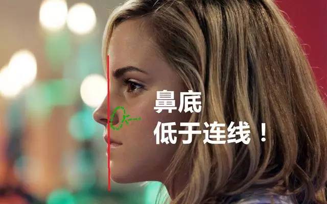 美女与野兽|天生法令纹只能靠整容吗?那是因为你没看这篇!