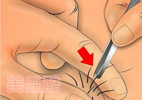 男士脱毛方法哪种最好,比基尼脱毛最好最安全的方法