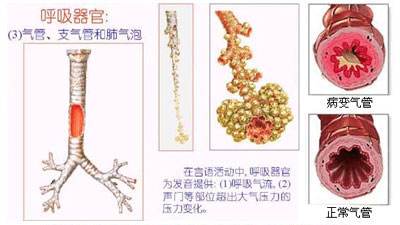 不用去医院！哮喘这么做，一招灵！90%的人都不知道！