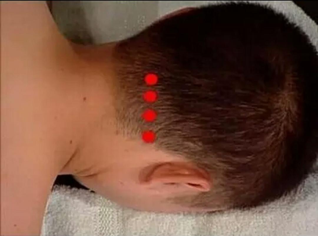 脑中风最佳抢救时间是多久,如何急救脑中风发作