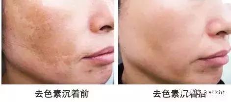 开什么玩笑合适,灯光真的可以美容吗