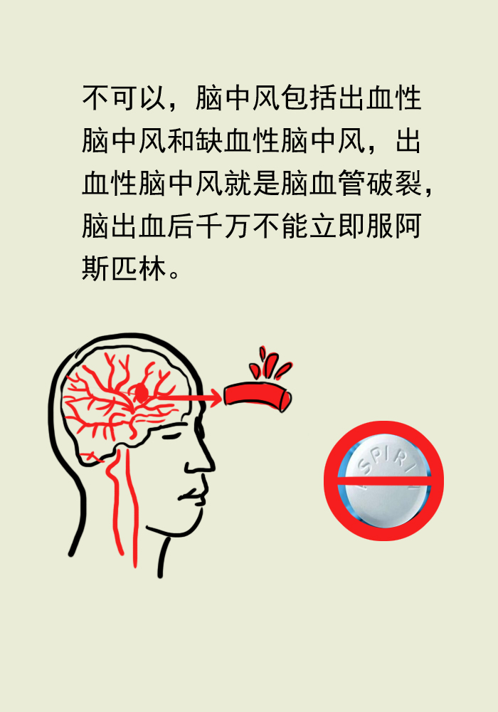 缺血性脑中风吃什么药调理,预防脑中风吃什么药有效果