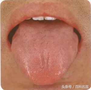 舌头舌诊,如何快速辨舌诊