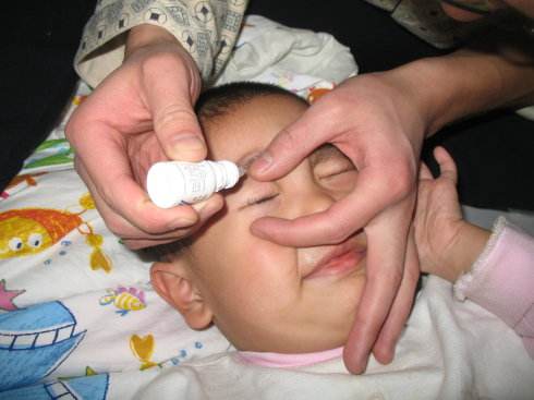 宝宝有眼屎多且黄还粘稠是上火吗,宝宝眼屎又黄又多怎么回事