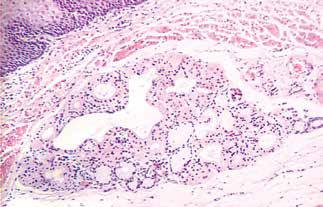 内镜做病理分析大概多久,作为一个医生太感性怎么办