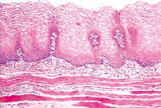 内镜做病理分析大概多久,作为一个医生太感性怎么办