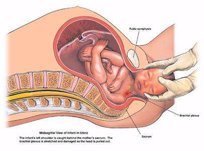 自然分娩过程介绍,自然分娩技巧训练