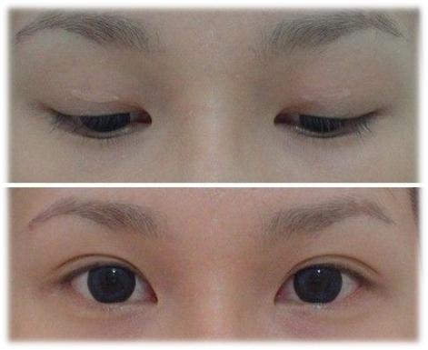 你是什么眼型原图,怎么让自己大小眼和眼袋变好看