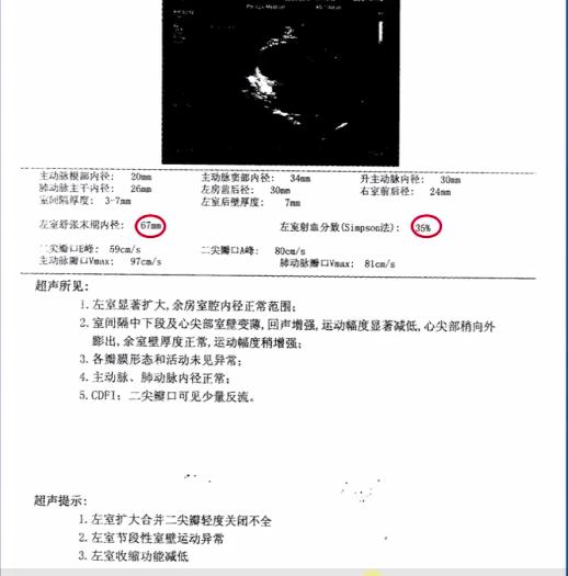 冠状动脉粥样硬化性心脏病知识点,冠状动脉粥样硬化性心脏病怎样治