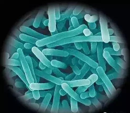 空调散热片脏了怎么回事,空调散热片污染