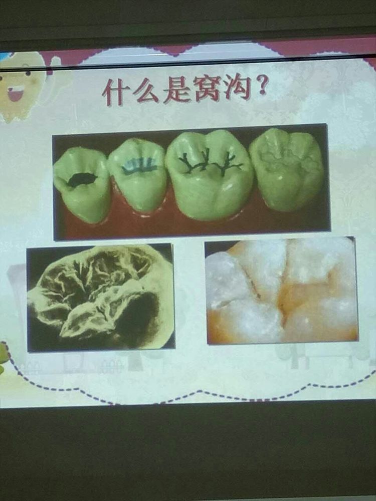阳泉康贝齿科贵不贵,阳泉康贝口腔医院