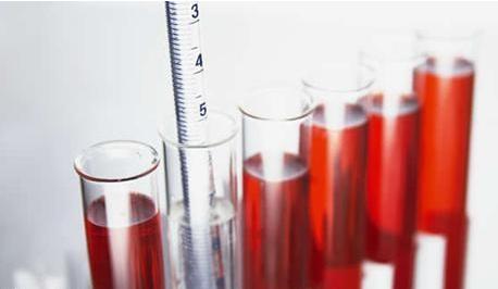 尿液颜色变深是什么原因,尿液颜色突然咖啡色