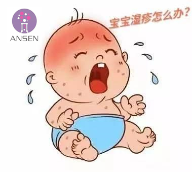 宝宝湿疹的物理治疗方法有,宝宝急性湿疹会自动好吗