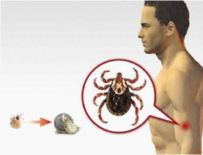 阳春四月、春暖花开出游时、采茶时得防——蜱虫叮咬